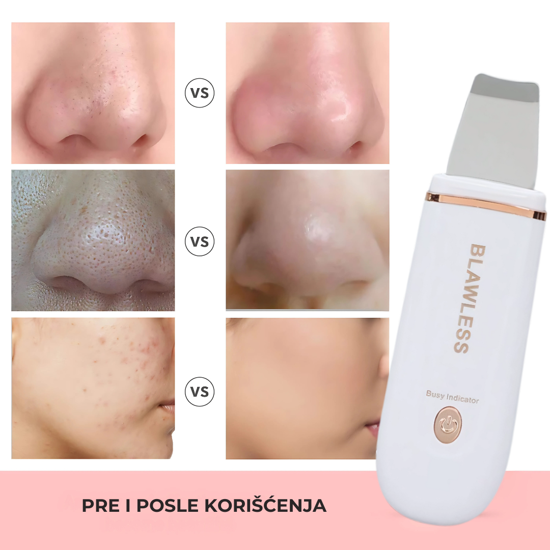 Ultrazvučna Špatula